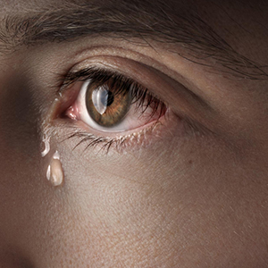 Watery Eyes
